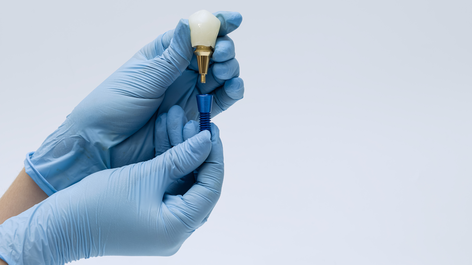 implant dentar Vaslui Elite BioDental