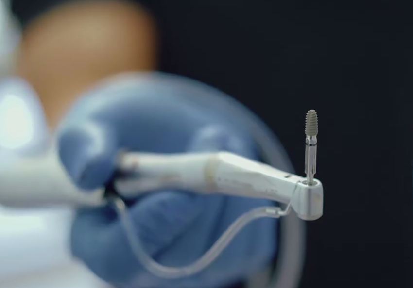 Implant dentar realizat în clinica Elite BioDental din Vaslui