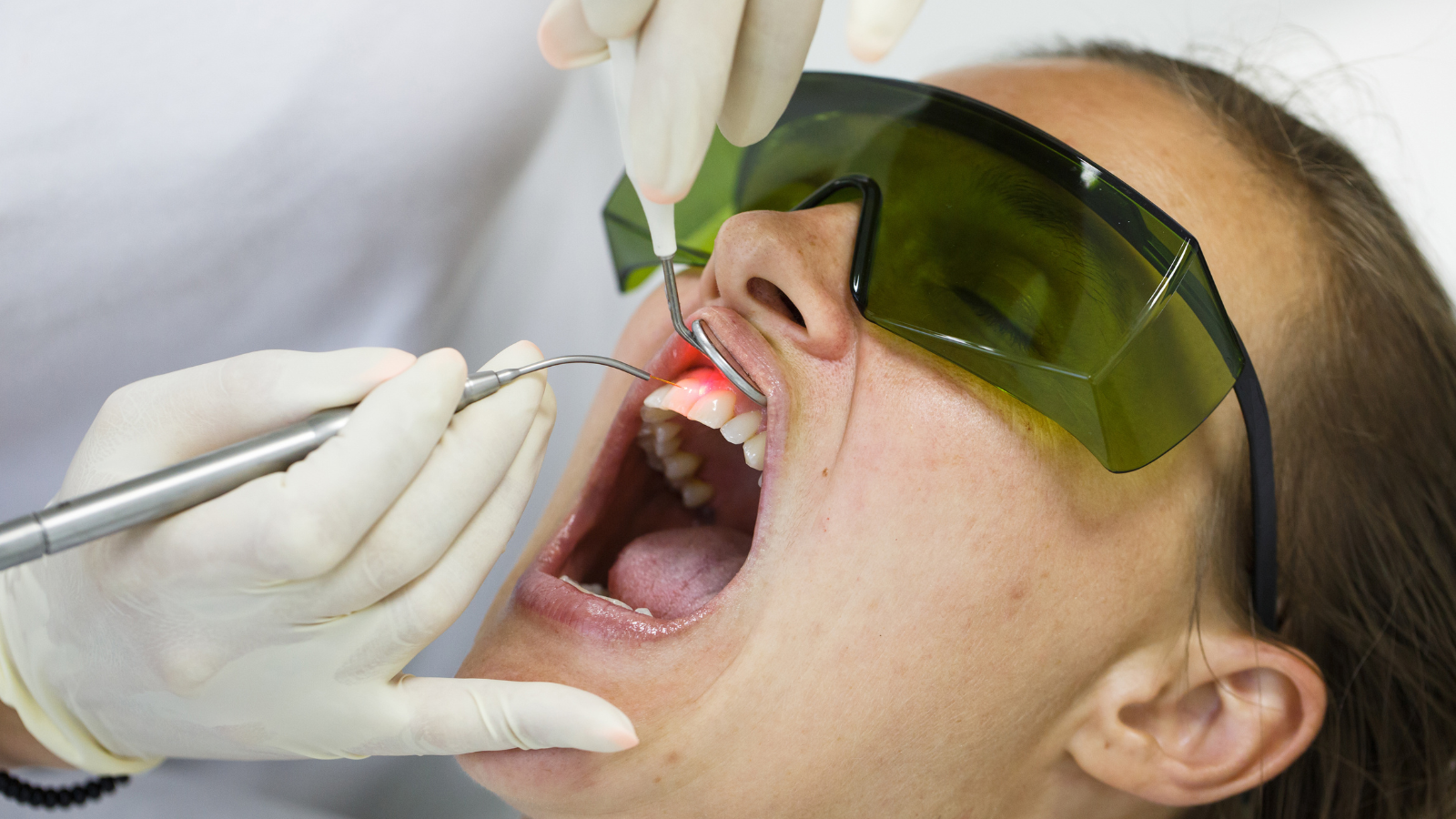 Boala parodontală tratament