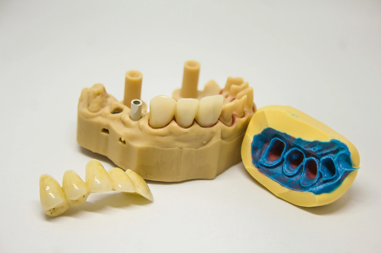 Lucrări de protetică dentară